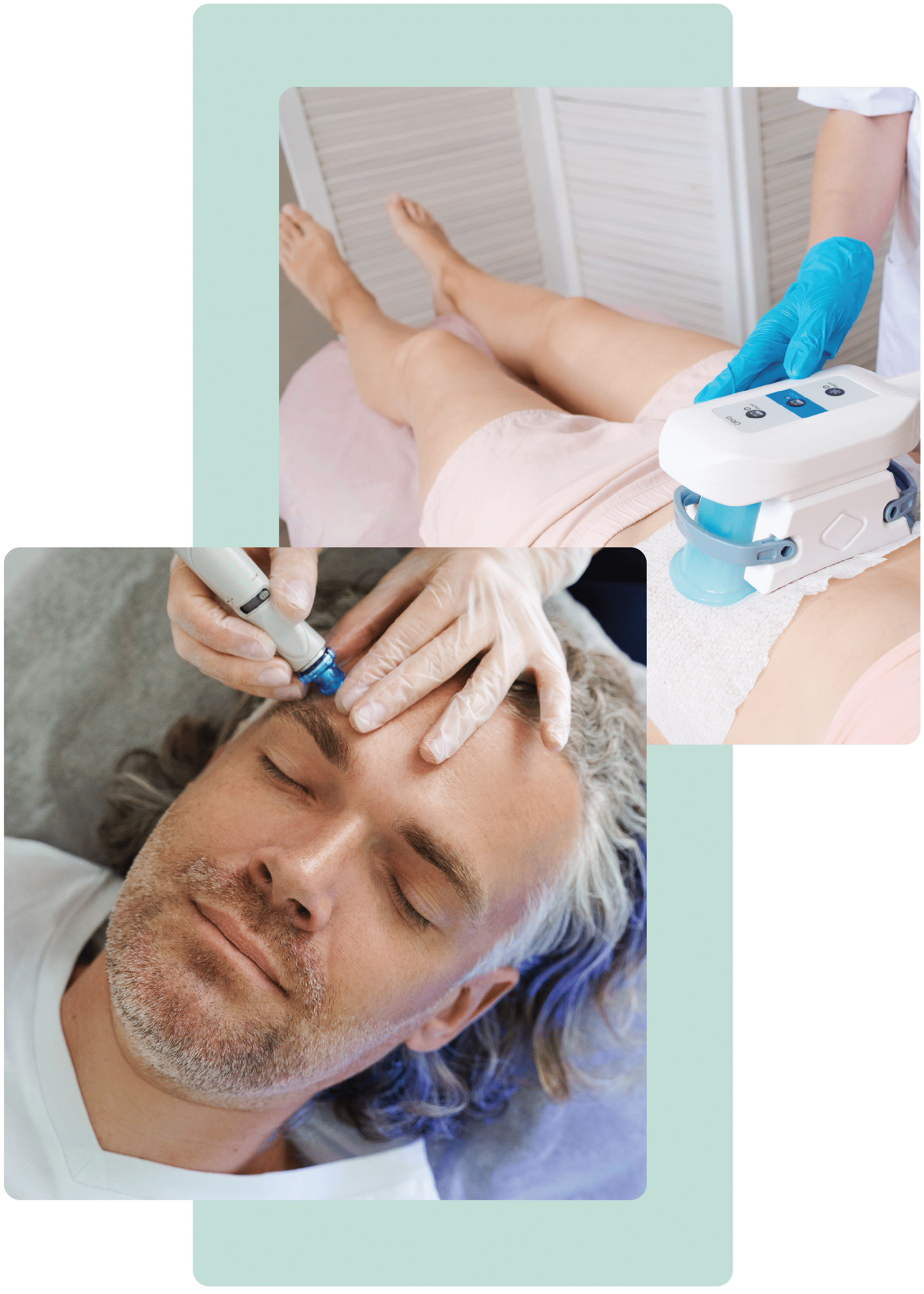face and body microneedling and coolsculpting treatment at chronos